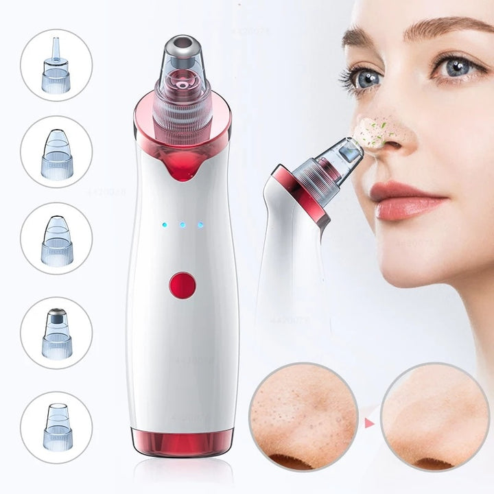 Removedor de Cravos Peeling Pro